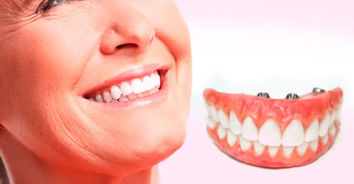 kunstgebitten Uw Weg Naar een Stralende Glimlach op Elke Leeftijd